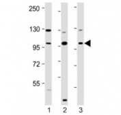 Western blot testing of VAV2 antibody at 1:2000: Lane 1) human HeLa, 2) MCF7 and 3) SH-SY5Y cell lysate. Predicted molecular weight ~100 kDa.