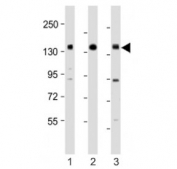 Western blot testing of RON antibody at 1:1000: Lane 1) human HACAT, 2) HCT116 and 3) SK-BR-3 cell lysate. Predicted molecular weight ~152 kDa (beta) and ~185 kDa (alpha/beta heterodimer).