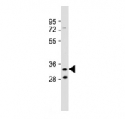 Western blot testing of TMEM106B antibody at 1:2000 + mouse brain lysate. Predicted molecular weight ~31 kDa.