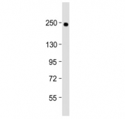 Western blot testing of human lung lysate with COL14A1 antibody at 1:2000. Predicted molecular weight ~194 kDa.