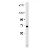 Western blot testing of mouse spleen tissue lysate with MPL antibody at 1:2000. Predicted molecular weight ~71 kDa.