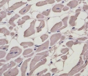 MYL1 Antibody Heart IHC. Immunohistochemistry analysis of FFPE human heart tissue stained with MYL1 antibody detecting Myosin light chain 1. Cardiac muscle fibers show weak to minimal cytoplasmic staining compared to skeletal muscle, consistent with the preferential expression of MYL1 in fast skeletal muscle fibers rather than cardiac muscle. The staining highlights elongated muscle fibers with low-level signal, while surrounding stromal elements remain largely negative. Hematoxylin counterstain highlights nuclei in blue. HIER: boil tissue sections in pH 6, 10 mM citrate buffer for 10-20 min and allow to cool before testing.