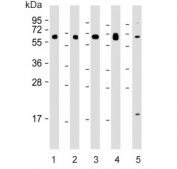Western blot testing of human 1) lung, 2) kidney, 3) pancreas, 4) testis and 5) MDA-MB-453 lysate with HHLA2 antibody. Expected molecular weight: 38-60 kDa depending on glycosylation level.