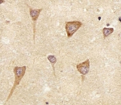 IHC testing of FFPE human brain tissue with Epiregulin antibody. HIER: steam section in pH6 citrate buffer for 20 min and allow to cool prior to staining.