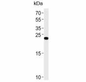 Western blot testing of human SH-SY5Y cell lysate with REG3G antibody. Expected molecular weight: 15-19 kDa.