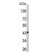 Western blot testing of human HepG2 cell lysate with AGXT antibody. Predicted molecular weight ~43 kDa.