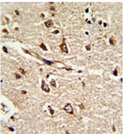 IHC testing of FFPE human brain tissue with PDIA6 antibody. HIER: steam section in pH6 citrate buffer for 20 min and allow to cool prior to staining.