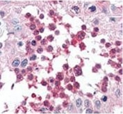 IHC testing of FFPE human testis tissue with HSPA5 antibody. HIER: steam section in pH6 citrate buffer for 20 min and allow to cool prior to staining.