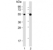 Western blot testing of 1) human skeletal muscle and 2) mouse C2C12 lysate with MCT4 antibody. Predicted molecular weight ~50 kDa.