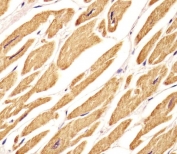 Immunohistochemistry of VLDL Receptor / VLDLR in human heart tissue. Formalin-fixed, paraffin-embedded human heart tissue stained with VLDL Receptor antibody shows strong cytoplasmic staining in cardiomyocytes, with signal distributed throughout myocardial fibers, while nuclei and surrounding interstitial areas show minimal staining. Antigen retrieval was performed by steaming tissue sections in citrate buffer, pH 6.0, for 20 minutes, followed by cooling prior to immunostaining.