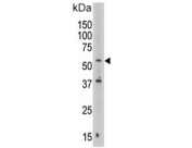 Western blot testing of human Jurkat lysate with Septin 9 antibody. Predicted molecular weight: 63-65 kDa (multiple isoforms).
