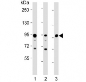 VIL1 Antibody for WB. Western blot analysis of Villin-1 (VIL1) protein expression in epithelial-derived lysates using a rabbit polyclonal antibody. Lane 1: human HT-29 lysate, Lane 2: human SW480 lysate, Lane 3: mouse colon lysate. A band is detected at approximately 93 kDa, consistent with the predicted molecular weight of Villin-1 / VIL1. Additional lower molecular weight bands are observed in some lanes, which may reflect proteolytic processing or partial degradation products commonly seen in cytoskeletal proteins under certain lysis conditions. The strong signal in colon-derived samples aligns with the known enrichment of Villin in intestinal epithelium, supporting its use as a robust western blot marker for epithelial brush border structure and differentiation.