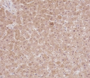 IHC testing of FFPE human liver tissue with RPS18 antibody. HIER: steam section in pH9 EDTA for 20 min and allow to cool prior to staining.