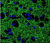 Synaptophysin Antibody for Immunofluorescence. Immunofluorescence staining of human brain tissue demonstrates dense punctate cytoplasmic fluorescence corresponding to Synaptophysin (SYP) localization in presynaptic vesicles throughout neuronal neuropil. Green fluorescent signal highlights abundant synaptic vesicle clusters characteristic of neuronal synapses, while DAPI counterstain (blue) marks cell nuclei. The staining pattern reflects the high synaptic density typical of brain tissue, where Synaptophysin-positive vesicles are distributed along neuronal processes and presynaptic terminals. This rabbit polyclonal Synaptophysin antibody was used to visualize synaptic vesicle protein localization in neuronal cells by fluorescence microscopy.