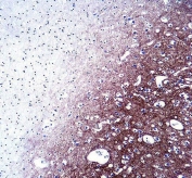 IHC testing of FFPE human brain tissue with Synaptophysin antibody. HIER: steam section in pH6 citrate buffer for 20 min and allow to cool prior to staining.