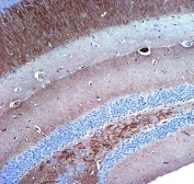 IHC testing of FFPE mouse hippocampus tissue with Synaptophysin antibody. HIER: steam section in pH6 citrate buffer for 20 min and allow to cool prior to staining.