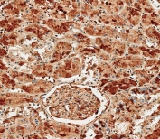 Albumin Antibody Human Kidney Tissue IHC. Immunohistochemistry staining testing of FFPE human kidney tissue with Albumin antibody. HIER: steam section in pH9 EDTA for 20 min and allow to cool prior to staining.