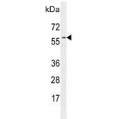 Western blot testing of hamster CHO cell lysate with GTPBP2 antibody. Predicted molecular weight 66 kDa with a possible ~46 kDa mutation product.