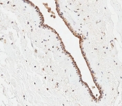 IHC testing of FFPE human breast tissue with CEPT1 antibody. HIER: steam section in pH9 EDTA for 20 min and allow to cool prior to staining.