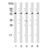 Western blot testing of human 1) HepG2, 2) Li-7, 3) U-87 MG, 4) testis and 5) mouse testis lysate with DHCR7 antibody. Predicted molecular weight ~54 kDa.