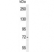 Western blot testing of mouse cerebellum lysate with ZBTB24 antibody. Predicted molecular weight ~78 kDa.