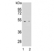 Western blot testing of human 1) K562 and 2) HeLa cell lysate with Carboxypeptidase B antibody. Predicted molecular weight ~45 kDa.