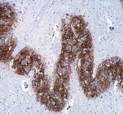 Synaptophysin Antibody Rabbit Polyclonal. Immunohistochemistry analysis of FFPE human brain tissue demonstrates strong cytoplasmic HRP-DAB brown staining consistent with Synaptophysin (SYP) localization in presynaptic vesicle compartments of neuronal tissue. Positive staining highlights neuronal processes and synapse-rich neuropil regions where synaptic vesicles are densely distributed, while surrounding tissue structures show minimal background signal. Hematoxylin counterstain marks nuclei in blue. The rabbit polyclonal Synaptophysin antibody was used to detect synaptic vesicle protein expression in human brain tissue. Heat-induced epitope retrieval was performed by steaming sections in pH6 citrate buffer for 20 minutes followed by cooling prior to staining.