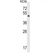 Western blot testing of human Y79 cell lysate with LYVE1 antibody. Expected molecular weight: 35-65 kDa depending on glycosylation level.