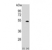 Western blot testing of 1) non-transfected and 2) transfected 293 cell lysate with LYVE1 antibody.