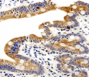 IHC testing of FFPE human small intestine tissue with ADRA1D antibody. HIER: steam section in pH6 citrate buffer for 20 min and allow to cool prior to staining.