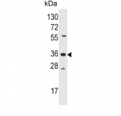 AKR1B1 Antibody Jurkat WB. Western blot testing of human Jurkat cell lysate with AKR1B1 antibody. Predicted molecular weight ~36 kDa.