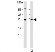Western blot testing of human 1) ovary and 2) spleen lysate with NTF3 antibody. Predicted molecular weight ~29 kDa.
