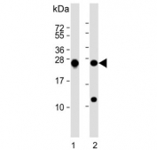 Western blot testing of human 1) K562 and 2) MCF7 cell lysate with PSMB1 antibody. Predicted molecular weight ~26 kDa.