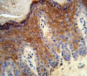 ALOX12 Antibody Human Skin IHC. Immunohistochemical staining of FFPE human skin tissue with ALOX12 antibody. Heat-induced epitope retrieval (HIER) was performed by steaming tissue sections in pH 6 citrate buffer for 20 minutes prior to staining. Strong cytoplasmic immunoreactivity is observed throughout the epidermis, consistent with the expected expression of 12S-Lipoxygenase (ALOX12), a lipid peroxidation enzyme that catalyzes arachidonic acid metabolism and contributes to epidermal differentiation, skin barrier homeostasis, inflammatory signaling, and oxidative stress responses. Cell nuclei are counterstained with hematoxylin (blue).