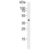 TBX1 Antibody HUVEC WB. Western blot analysis of human HUVEC cell lysate using TBX1 Antibody / Developmental Transcription Factor Antibody demonstrates a distinct immunoreactive band at approximately 43 kDa, consistent with the predicted molecular weight of T-Box Transcription Factor 1 (TBX1). TBX1 is a member of the T-box family of developmental transcription factors that regulate gene expression programs involved in embryonic patterning, tissue specification, and organogenesis. TBX1 has been implicated in developmental pathways associated with cardiovascular morphogenesis, pharyngeal arch formation, and cellular differentiation. Detection of TBX1 in human endothelial cells is consistent with its role in transcriptional networks that contribute to vascular and cardiovascular development. The observed band supports the utility of this antibody for western blot detection of TBX1 expression in endothelial and developmental biology research applications. Predicted molecular weight: ~43 kDa.