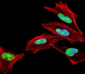TBX1 Antibody Nuclear Localization IF. Immunofluorescent staining of fixed and permeabilized human A2058 cells using TBX1 Antibody / Developmental Transcription Factor Antibody demonstrates prominent nuclear localization of TBX1 (green). Nuclei are counterstained with DAPI (blue), while actin cytoskeletal filaments are visualized with anti-Actin antibody (red). TBX1 is a T-box family transcription factor that regulates developmental gene expression programs involved in embryonic patterning, tissue specification, and organogenesis. As a DNA-binding regulatory protein, TBX1 functions primarily within the nucleus where it controls transcriptional networks associated with cellular differentiation and developmental morphogenesis. The observed nuclear staining pattern is consistent with the established role of TBX1 as a developmental transcription factor and supports the utility of this antibody for immunofluorescent detection of TBX1 expression and subcellular localization.