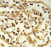 TBX1 Antibody Human Testis IHC. Immunohistochemical staining of FFPE human testis tissue using TBX1 Antibody / Developmental Transcription Factor Antibody demonstrates prominent nuclear HRP-DAB brown staining within cells of the seminiferous tubules. TBX1 is a T-box family transcription factor that regulates developmental gene expression programs involved in tissue specification, cellular differentiation, and organogenesis. As a DNA-binding regulatory protein, TBX1 functions primarily within the nucleus where it controls transcriptional networks that coordinate developmental and cell fate determination pathways. The observed nuclear staining pattern is consistent with the expected localization of a transcription factor and supports the utility of this antibody for immunohistochemical detection of TBX1 expression in human tissues. HIER: steam tissue sections in pH 6 citrate buffer for 20 minutes and allow to cool prior to staining.