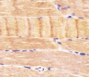 IHC testing of FFPE human skeletal muscle tissue with CDK5 antibody. HIER: steam section in pH6 citrate buffer for 20 min and allow to cool prior to staining.