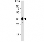 Western blot testing of recombinant human partial protein with Myosin 18B antibody. 