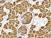 IHC testing of FFPE human kidney tissue with CD10 antibody. HIER: steam section in pH6 citrate buffer for 20 min and allow to cool prior to staining.