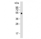 Western blot testing of human liver lysate with UGT2B4 antibody. Predicted molecular weight: 43/46/61 kDa (three isoforms).