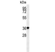 Western blot testing of human MDA-MB-453 cell lysate with Exonuclease V antibody. Predicted molecular weight ~42 kDa.