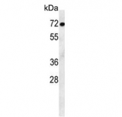 Western blot testing of mouse stomach lysate with ATF7IP2 antibody. Predicted molecular weight ~76 kDa.