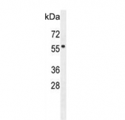 Western blot testing of human HeLa cell lysate with FBXW8 antibody. Predicted molecular weight ~67 kDa.