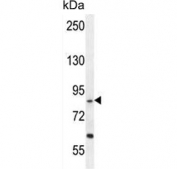Western blot testing of human HepG2 cell lysate with EXOC3L1 antibody. Predicted molecular weight ~82 kDa.