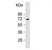 Western blot testing of human Ramos cell lysate with KNG1 antibody. Predicted molecular weight ~72 kDa.
