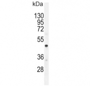 CMGA Antibody WB. Western blot testing of human A549 cell lysate with CMGA antibody. Expected molecular weight: 50-75 kDa depending on glycosylation level.
