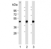 P2RY5 Antibody Human and Mouse WB. Western blot testing of P2RY5 Antibody using lysates from 1) human MOLT4 cells, 2) human HepG2 cells, and 3) mouse heart tissue. A distinct band is detected at approximately 39 kDa in each sample, consistent with the predicted molecular weight of LPAR6/P2RY5. These results demonstrate that P2RY5 Antibody, a Lysophosphatidic Acid Receptor Antibody, specifically recognizes endogenous receptor expression in both human cell lines and mouse tissue, supporting its utility for cross-species protein detection.