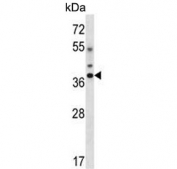 DLX5 Antibody Human HL60 Cell WB. Western blot analysis of human HL60 cell lysate using DLX5 Antibody. A distinct immunoreactive band is detected at approximately 38-40 kDa, migrating above the predicted molecular weight of approximately 32 kDa. This difference may reflect post-translational modification, isoform-dependent migration, or other factors affecting electrophoretic mobility. These results demonstrate that DLX5 Antibody, a Homeobox Transcription Factor Antibody, detects endogenous DLX5 in human HL60 cells.