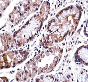 DLX5 Antibody Human Stomach IHC. Immunohistochemical analysis of FFPE human stomach tissue using DLX5 Antibody. Heat-induced epitope retrieval was performed in pH 6.0 citrate buffer prior to incubation with the primary antibody. An HRP-conjugated secondary antibody with DAB chromogen was used for visualization. Moderate to strong nuclear staining with accompanying cytoplasmic signal is observed in the gastric epithelial cells, consistent with the expected localization of DLX5 as a homeobox transcription factor. These results demonstrate that DLX5 Antibody, a Homeobox Transcription Factor Antibody, specifically detects endogenous DLX5 in FFPE human stomach tissue.